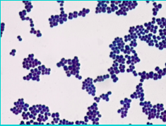 What’s a Gram Stain? – The Vaccine Mom
