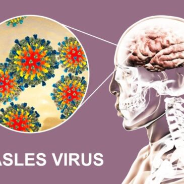 The measles…years after your child gets sick.